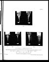Thumbnail of file (67) Plate Ib - Choleraic comma-bacilli &c.