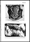 Thumbnail of file (192) Plate XIII