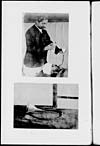 Thumbnail of file (32) [2 sepia photographs] - [Forcible feeding of asylum patient]