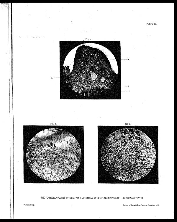 (35) Plate III - Photo-micrographs of sections of small intestine in case of "peshawar fever"