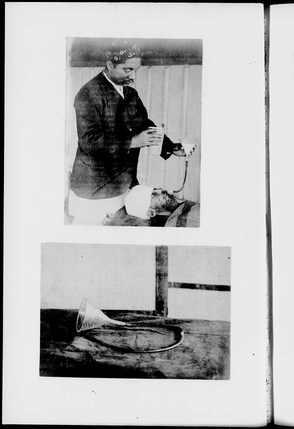 (28) [2 sepia photographs] - [Forcible feeding of asylum patient]