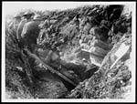 X.32057Wounded Tommy being removed from trench