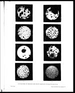 PlateCultivations of unboiled and boiled samples of milk in Calcutta